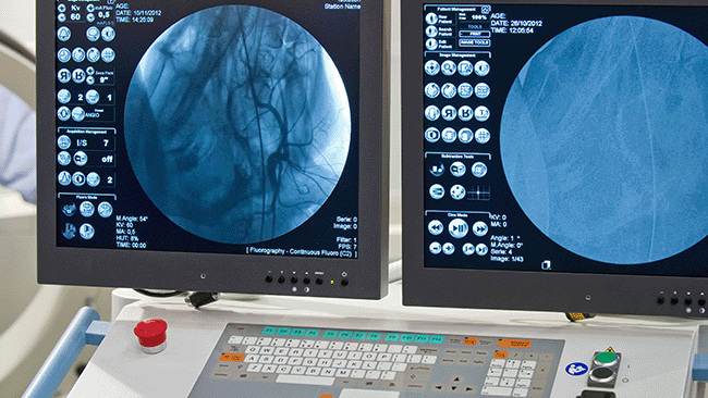 Abbildung eines Bildes auf dem Monitor nach einer Kontrastechokardiographie.