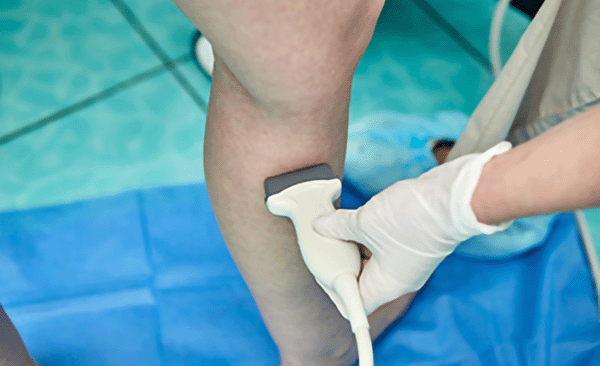 Darstellung Ultraschalluntersuchung eines Beines.