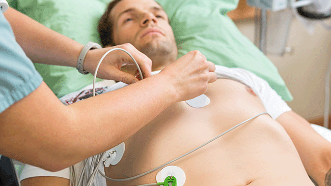 Abbildung eines Mannes mit EKG Elektroden am Körper.